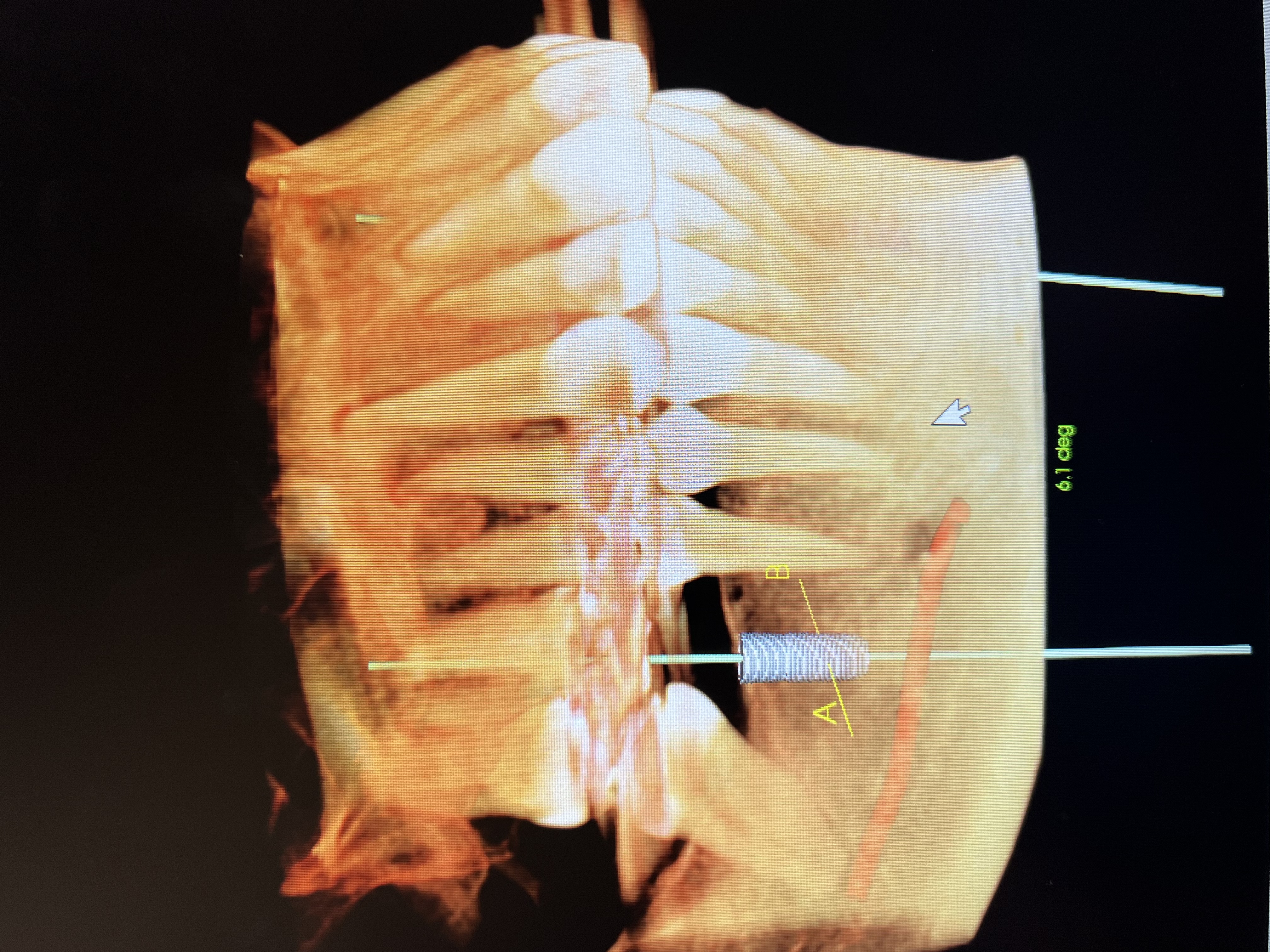 Local Business Listing